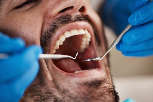 Best Emergency Dental Care for Broken or Chipped Teeth in Bath, ME